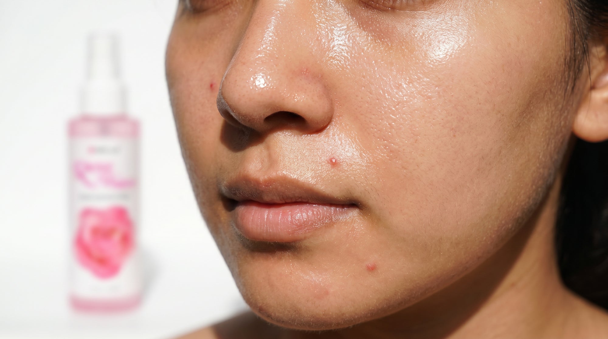 A woman with oily and acne-prone skin, considering to use Well's Oil Rose water to hydrate and balance out to have healthy skin.